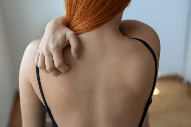 Choosing The Ultimate Best Shower Gel For Eczema 1