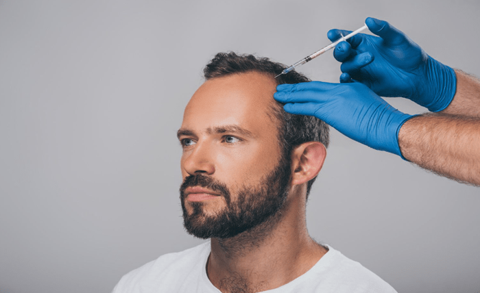 How Effective Is PRP Hair Loss Treatment Compared to Other Services in Auckland? Screenshot 1 17