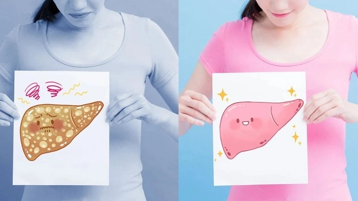 7 signes qui montrent que votre foie est malade