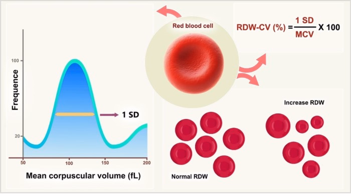 RDW and Cardiovascular Risk What the Research Says