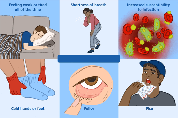Symptoms That May Accompany a Dangerous RDW Level