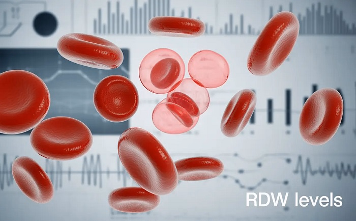 What Level of RDW Is Dangerous 1