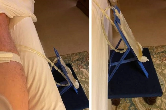 How to Use a Night Drainage Bag